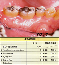 術後